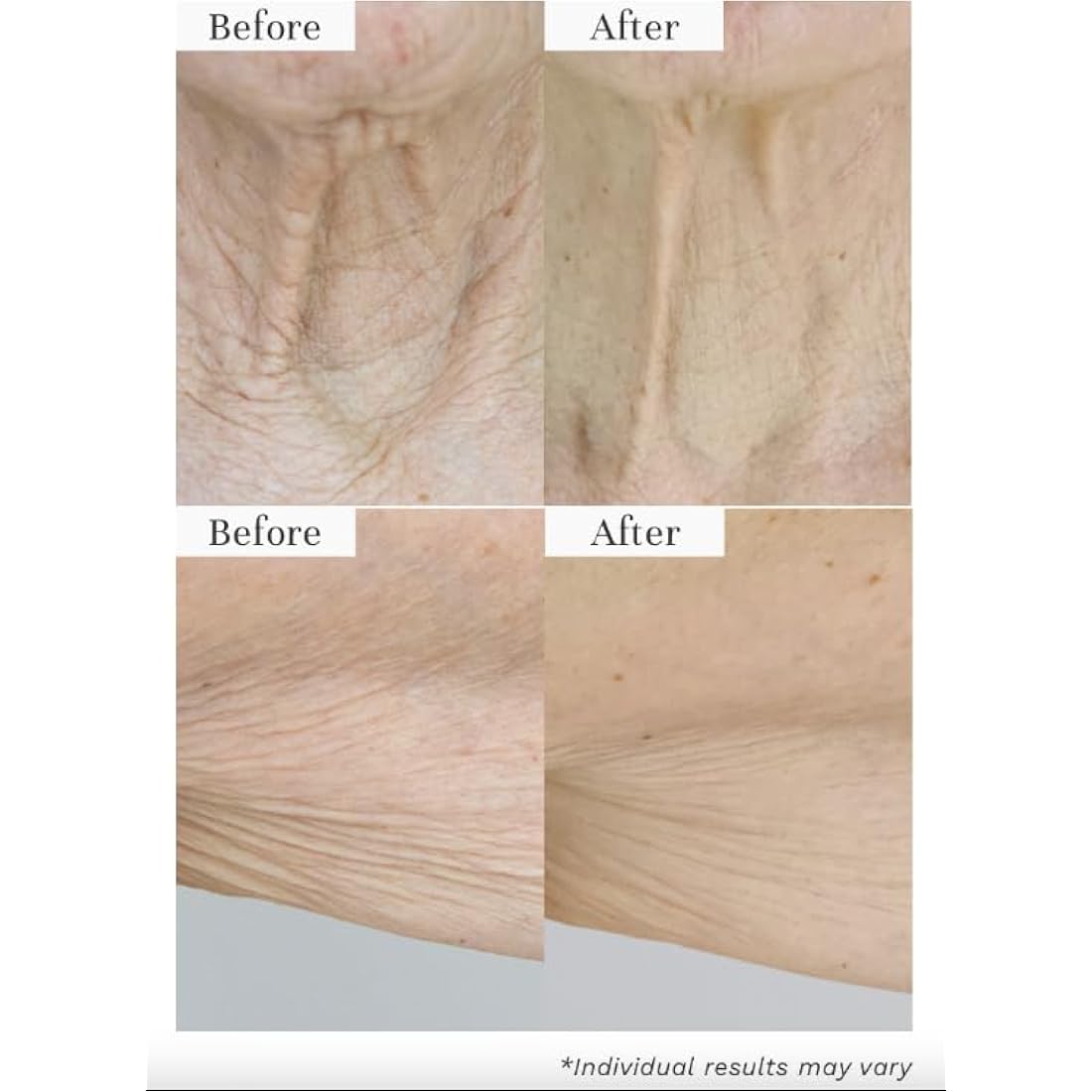 City Beauty InvisiCrepe Body Balm - Skin Firming & Tightening Lotion for a Smoother, Firmer Look | Anti-Aging Firming Body Cream